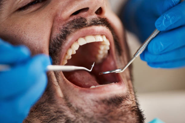 Best Walk-In Emergency Dentist in Maryville, TN